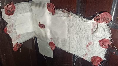 «صحة الغربية»: غلق وتشميع مركز طبي متخصص بالمحلة