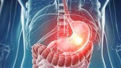 تعرف على الفحوصات المطلوبة وطريقة علاج ارتجاع المرىء 