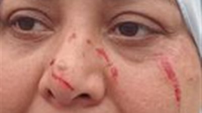 بالصور.. شخص يتعدي علي زوجة أخيه في الزرقا