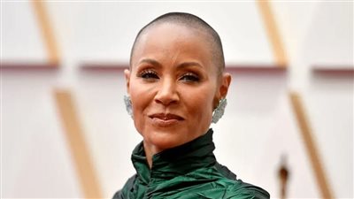 ما هو مرض الثعلبة سبب لكمة ويل سميث لمذيع أوسكار؟! 