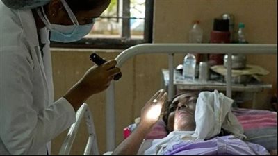تفاصيل إصابة أول ممرضة بالفطر الأسود وفقدانها نصف وجهها 