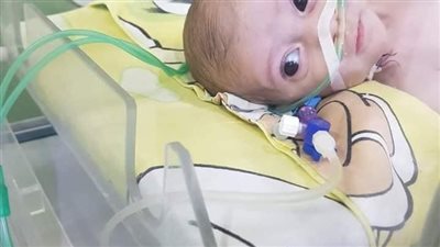 نداء لوزير الصحة من جروب مدينة بدر الأن.. انقذوا هذا الطفل