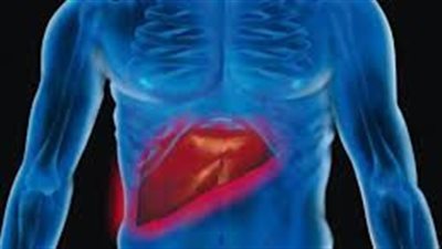 في اليوم العالمي لالتهاب الكبد.. أعراضه وأنواعه وعلاجه 