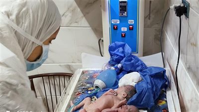 سيدة تضع 5 توائم في ولادة قيصرية بمستشفى المنشاوي بطنطا