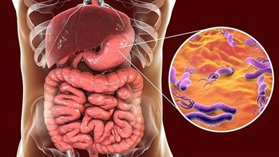 أدوية تتداخل مع نتائج تحاليل جرثومة المعدة.. احذرها