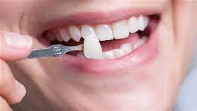 الفرق بين الفينير والهوليود سمايل.. استشاري تجميل يوضح 