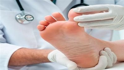 خبير يوضح احتمالية خطر حدوث قرحة القدم السكري