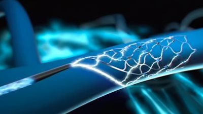 لأول مرة.. غرسة طبية دائمة يمكن رجل مشلول من التواصل الكامل