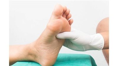 قد يسبب البتر.. استشاري يحذر من إهمال علاج الشرايين الطرفية