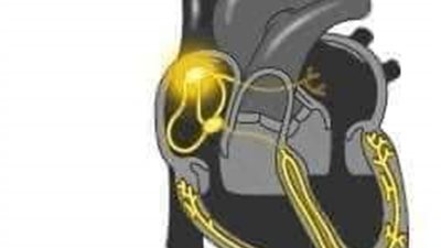 شغال بالكهرباء.. طبيب شهير يفجر مفاجأة بشأن آلية عمل القلب