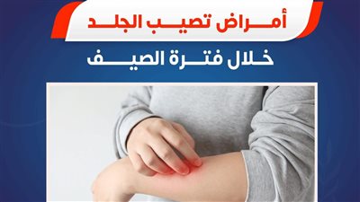 الصحة تكشف عن أمراض تُصيب الجلد خلال فترة الصيف