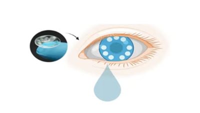 علماء يبتكرون عدسات لاصقة ذكية لهذا الغرض!