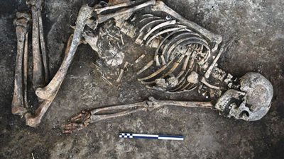 علماء يرصدون أدلة على نجاح عمليات بتر جراحي قبل 31 ألف عام