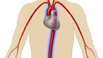 تعرف على مخاطر الإصابة بتمدد الشريان الأورطي