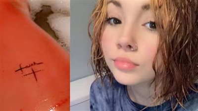 فتاة أمريكية تعاني من حالة نادرة جدًا من حساسية الماء!