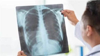 أبرز مخاطر إهمال علاج الالتهاب الرئوي