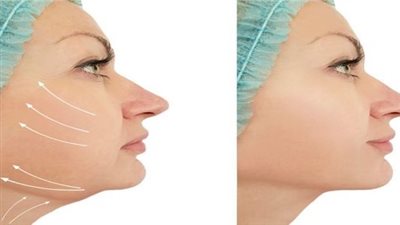 خبير يوضح أسباب ظهور الذقن المزدوج عند النساء