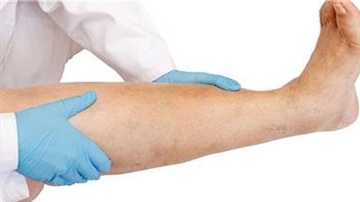 عادات يحميك الإقلاع عنها من أمراض الأوعية الطرفية