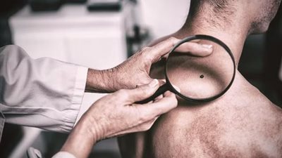 علامات تحذيرية يجب الانتباه لها قبل الإصابة بـ السرطان