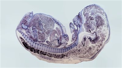 هل يمكن أن تتم عملية الإنجاب دون حيوان منوي أو بويضة؟!