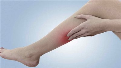 أعراض وأسباب وعلاج جلطات الساق الوريدية