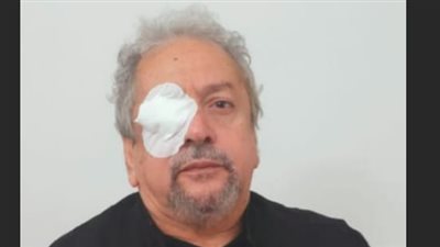 المخرج عمر عبد العزيز يجرى جراحة دقيقة