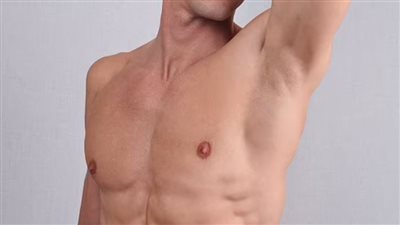 لاصقة معدنية يمكنها علاج فرط التعرق في ثلاث دقائق فقط