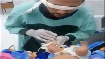 ممرض معصوب العينين يركب كانيولا لرضيع.. تحرك عاجل من الصحة
