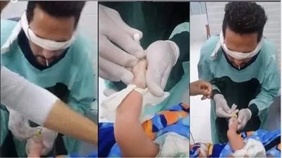 فيديو تركيب كانيولا لطفل حديث الولادة يفتح النار على اكاديميات التمريض الوهمية 