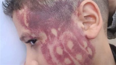 بالصور/ مدرس يعتدي على طالب بوحشية.. ومؤسس 