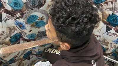 مصدر طبي يكشف لـ 