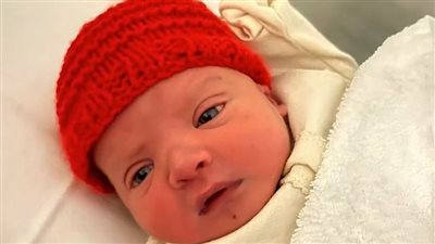 ما هي متلازمة حذف الكروموسومات النادرة؟ وكيف تؤثر على الأطفال حديثي الولادة؟