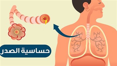 استشاري أمراض صدرية يحذر مرضى الحساسية من الطقس البارد