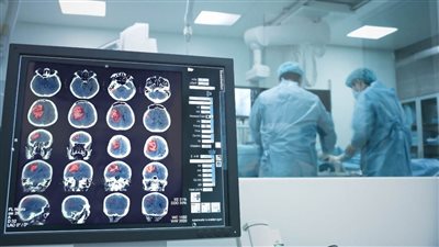 في إيطاليا.. مريض يلعب الساكسوفون أثناء إجراء جراحة إزالة ورم من المخ!