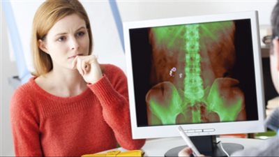 تقنية حديثة لتفتيت حصوات الكلى دون تخدير