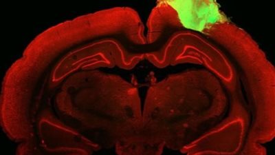 علماء ينجحون في علاج العمى باستخدام أجزاء من دماغ الفأر 