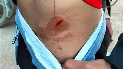 اعتداءات دامية على لاعبي نادي الإعلاميين بعد مباراة مع نادي الشمس