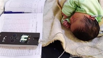 فحص 12 ألف طفل حديث الولادة ضمن 