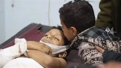 تفاصيل مقتل طفل بطلق ناري راجع في محافظة تعز