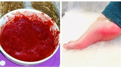 طريقة عمل كريم دم الغزال لتوريد القدمين بطريقة آمنة في المنزل