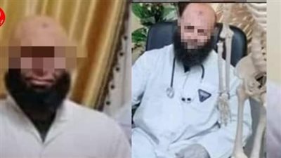 طلع بتاع كشري.. مفاجأة تكشفها التحقيقات في قضية طبيب السويس المزيف