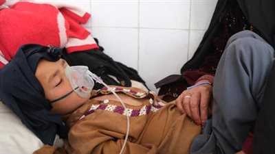 اليمن.. طبيب في صنعاء يحذر من تحول مرض الحصبة إلى وباء