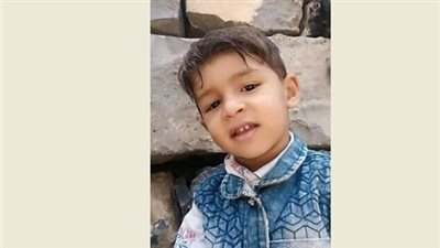 اليمن.. وفاة طفل متأثرا بالحصبة الألمانية بعد انتشارها في محافظة حجة