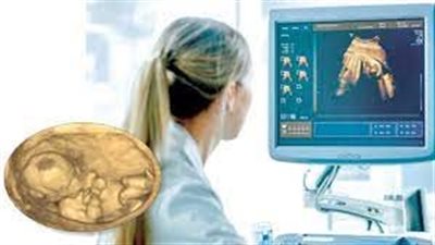 دعوات غربية لإيقاف تطوير الذكاء الاصطناعي 