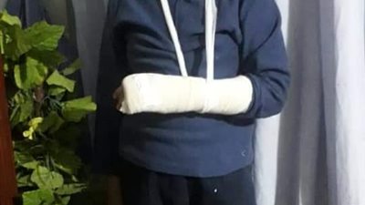 أصابه بشرخ في مفصل اليد.. آخر تطورات تعدي مدير مدرسة تجريبية على طالب (صور) 