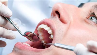كيف تكشف صحة الفم أسرار صحتك العامة؟