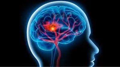 لأول مرة.. اكتشاف أكثر أجزاء الدماغ تأثرا بارتفاع ضغط الدم