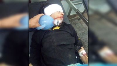 ألعاب حارقة وصواريخ تتسبب في إصابة فتاة بالغربية