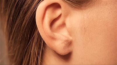ما علاقة طنين الأذن بفيروس كورونا؟ 
