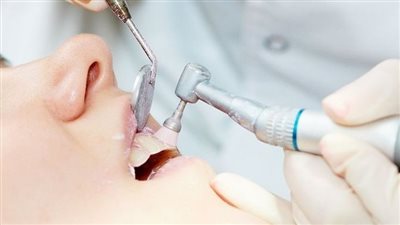  نجاح أول عملية زراعة أسنان بمكون مصري بنسبة 70%